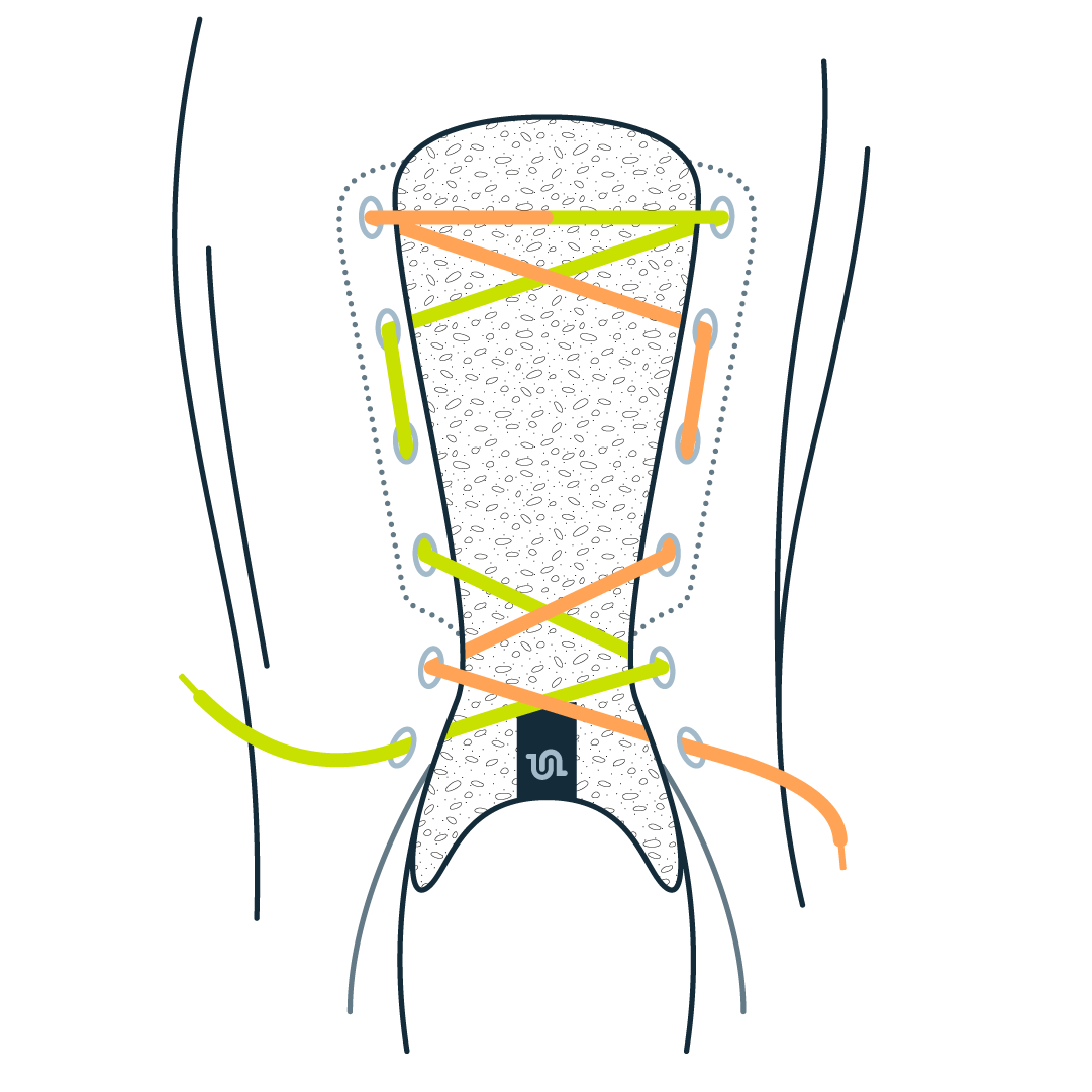 High Arches Lacing Methods